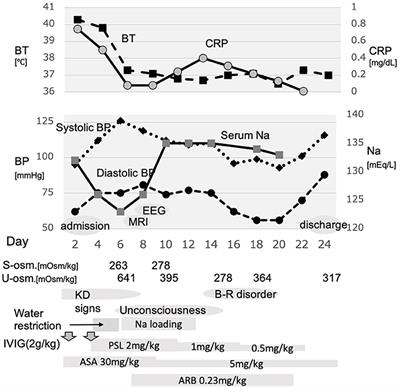 A Case of Kawasaki Disease Complicated With Cerebral Salt-Wasting Syndrome